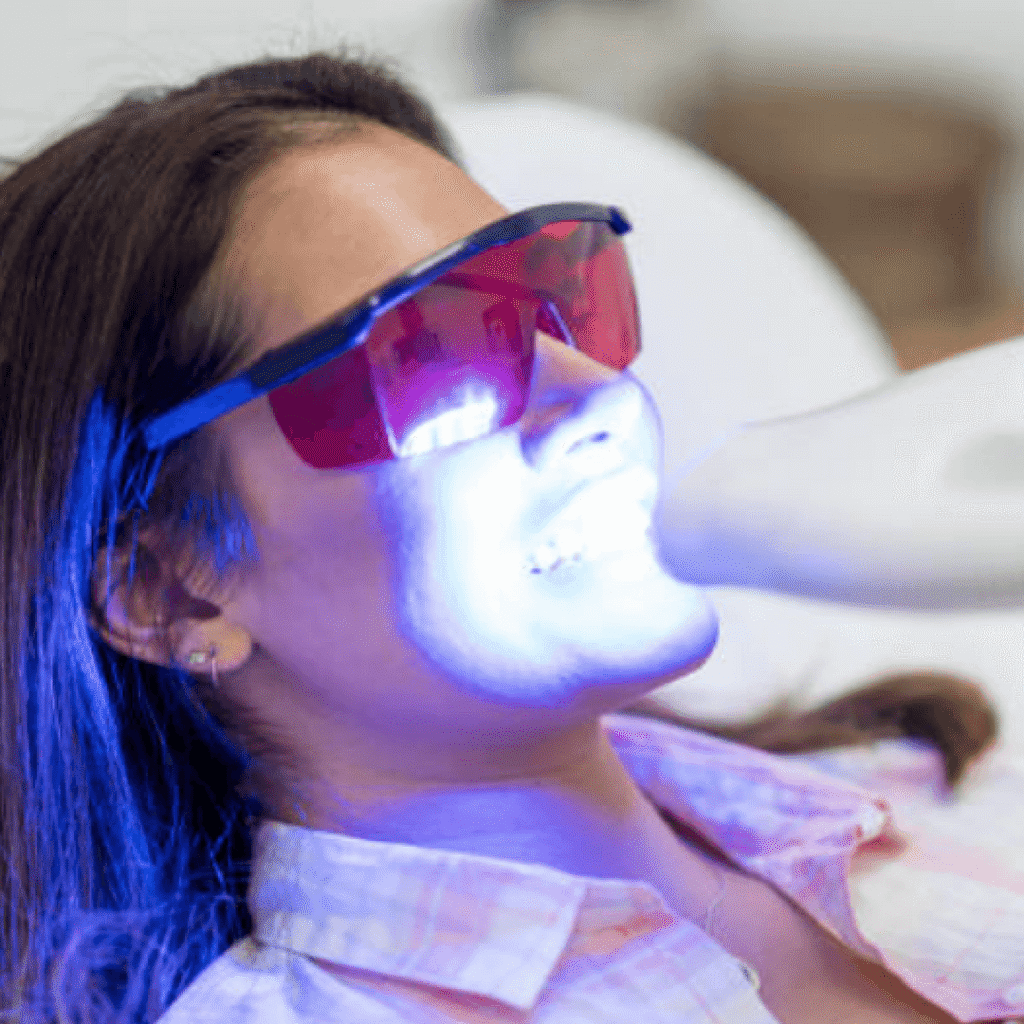 LED Teeth Whitening Service