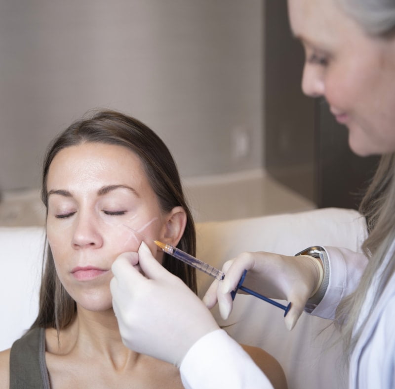 Under Eye Dermal Filler