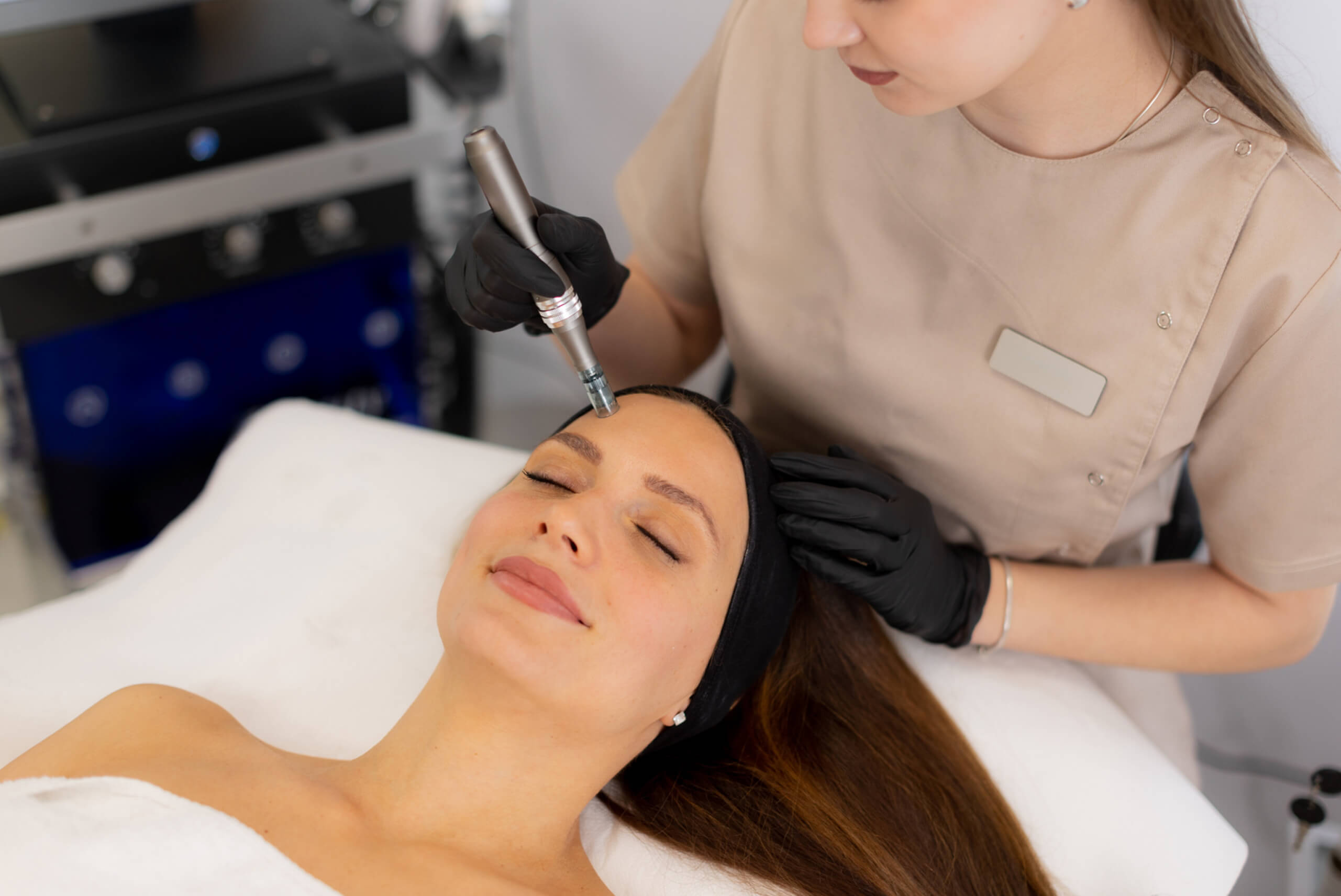 Microneedling Treatment