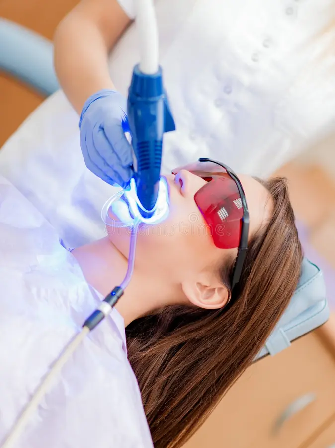 Professional LED Teeth Whitening